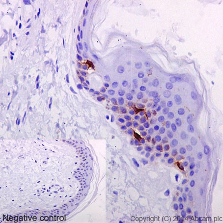 Immunohistochemistry (Formalin/PFA-fixed paraffin-embedded sections) - Anti-Langerin antibody [EPR15863] - BSA and Azide free (AB232603), expandable thumbnail