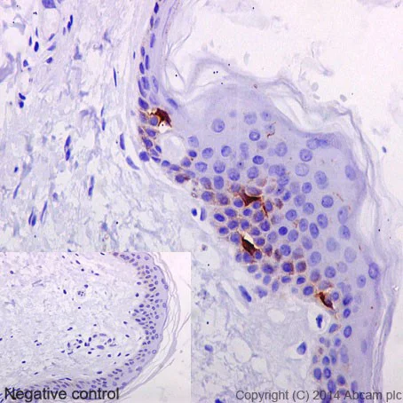 Immunohistochemistry (Formalin/PFA-fixed paraffin-embedded sections) - Anti-Langerin antibody [EPR15863] - BSA and Azide free (AB232603)