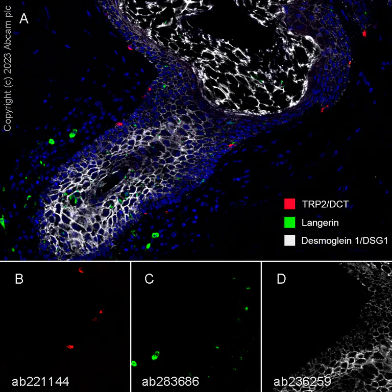 Multiplex immunohistochemistry - Anti-Langerin antibody [EPR24685-12] (AB283686)