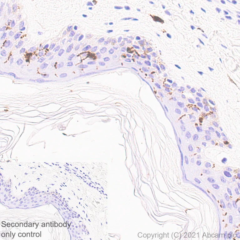Immunohistochemistry (Formalin/PFA-fixed paraffin-embedded sections) - Anti-Langerin antibody [EPR24685-12] - BSA and Azide free (AB283714)