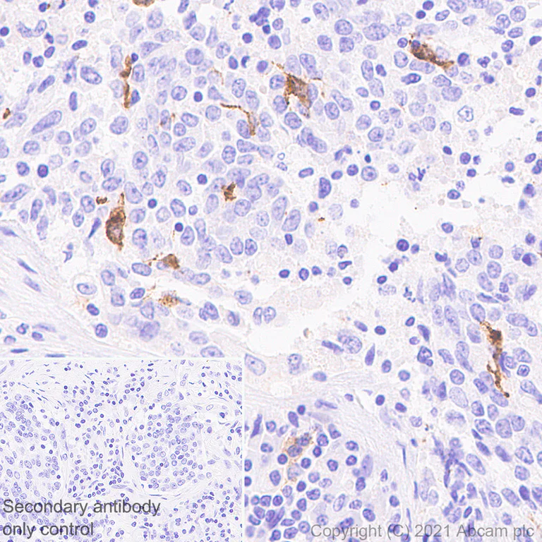 Immunohistochemistry (Formalin/PFA-fixed paraffin-embedded sections) - Anti-Langerin antibody [EPR24685-12] - BSA and Azide free (AB283714)