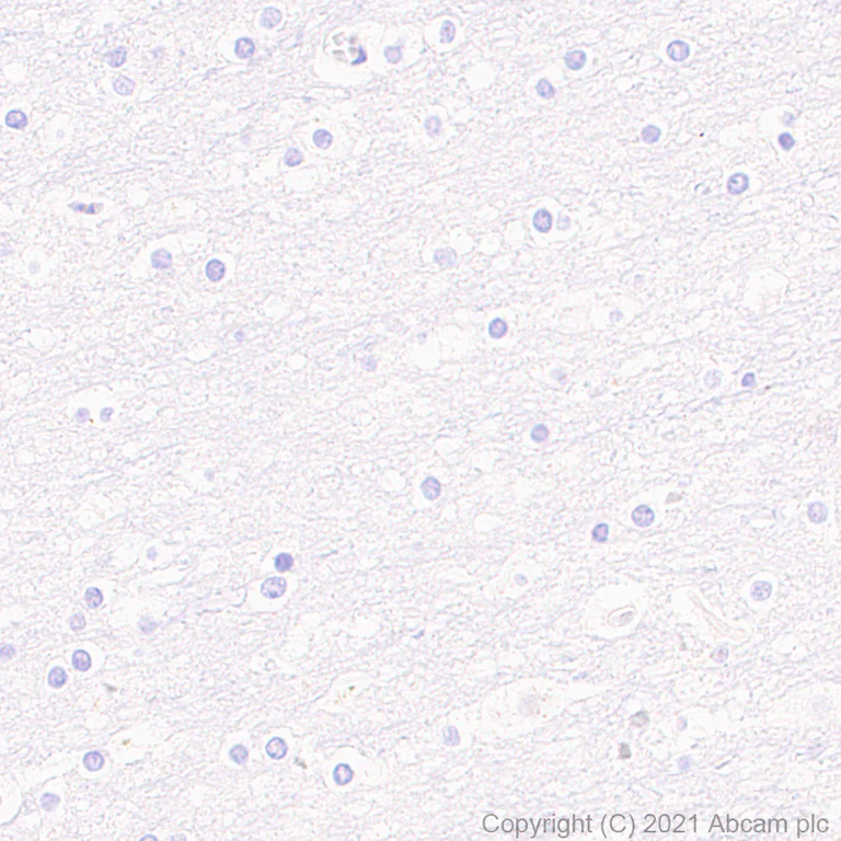 Immunohistochemistry (Formalin/PFA-fixed paraffin-embedded sections) - Anti-Langerin antibody [EPR24685-12] - BSA and Azide free (AB283714)