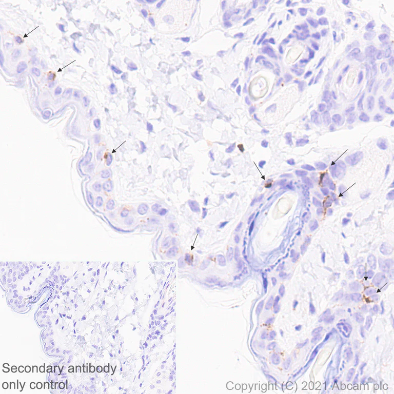 Immunohistochemistry (Formalin/PFA-fixed paraffin-embedded sections) - Anti-Langerin antibody [EPR24685-12] - BSA and Azide free (AB283714)