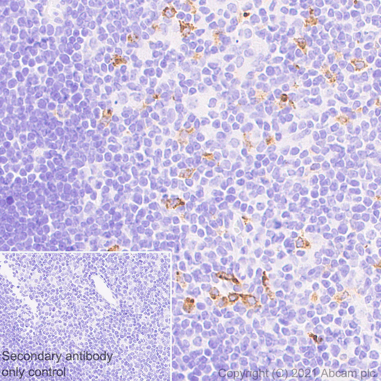 Immunohistochemistry (Formalin/PFA-fixed paraffin-embedded sections) - Anti-Langerin antibody [EPR24685-12] - BSA and Azide free (AB283714)