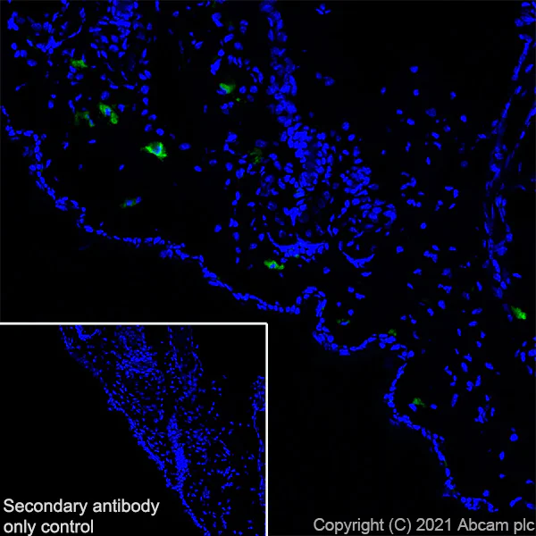 Immunohistochemistry (Frozen sections) - Anti-Langerin antibody [EPR24685-12] - BSA and Azide free (AB283714)