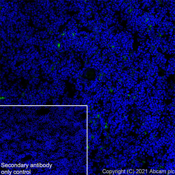 Immunohistochemistry (Frozen sections) - Anti-Langerin antibody [EPR24685-12] - BSA and Azide free (AB283714)