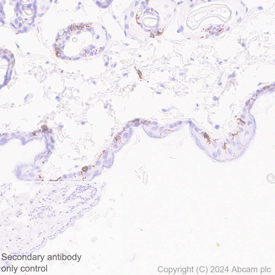 Immunohistochemistry (Formalin/PFA-fixed paraffin-embedded sections) - Anti-Langerin antibody [EPR28089-89] (ab317813), expandable thumbnail