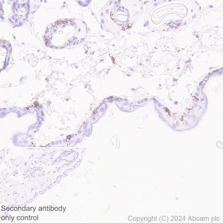 Immunohistochemistry (Formalin/PFA-fixed paraffin-embedded sections) - Anti-Langerin antibody [EPR28089-89] (AB317813)