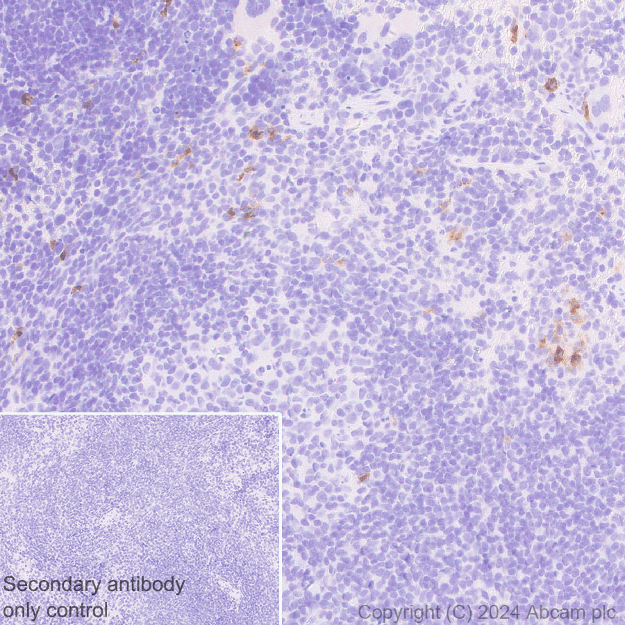 Immunohistochemistry (Formalin/PFA-fixed paraffin-embedded sections) - Anti-Langerin antibody [EPR28089-89] (AB317813), expandable thumbnail