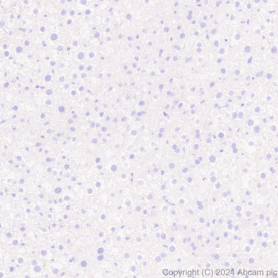 Immunohistochemistry (Formalin/PFA-fixed paraffin-embedded sections) - Anti-Langerin antibody [EPR28089-89] (ab317813), expandable thumbnail