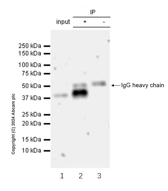 Immunoprecipitation - Anti-Langerin antibody [EPR28089-89] (AB317813), expandable thumbnail