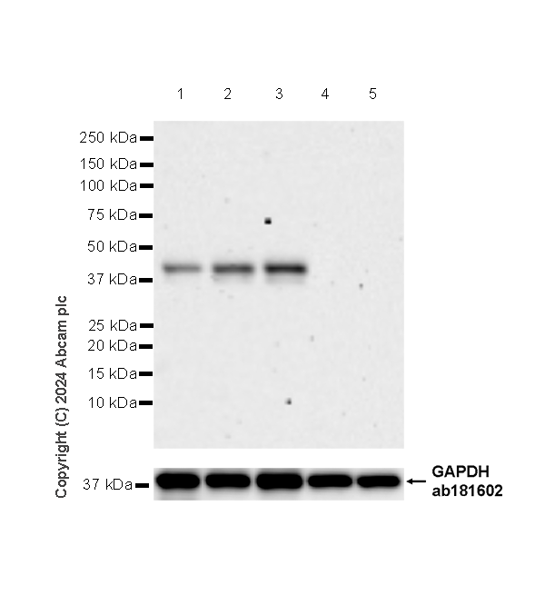 Western blot - Anti-Langerin antibody [EPR28089-89] (AB317813), expandable thumbnail