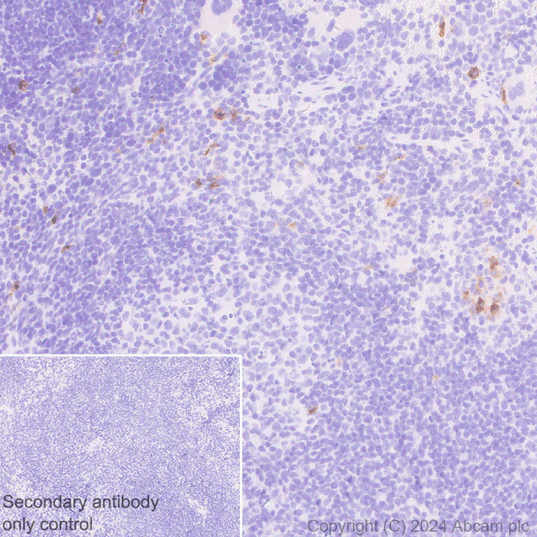 Immunohistochemistry (Formalin/PFA-fixed paraffin-embedded sections) - Anti-Langerin antibody [EPR28089-89] - BSA and Azide free (AB317814)