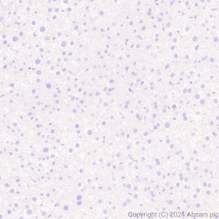 Immunohistochemistry (Formalin/PFA-fixed paraffin-embedded sections) - Anti-Langerin antibody [EPR28089-89] - BSA and Azide free (AB317814)