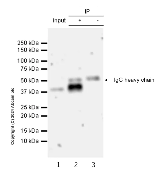 Immunoprecipitation - Anti-Langerin antibody [EPR28089-89] - BSA and Azide free (AB317814)
