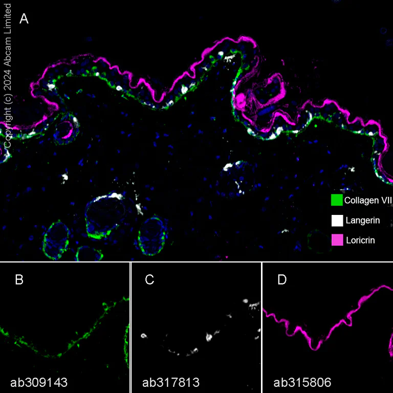 Multiplex immunohistochemistry - Anti-Langerin antibody [EPR28089-89] - BSA and Azide free (AB317814)