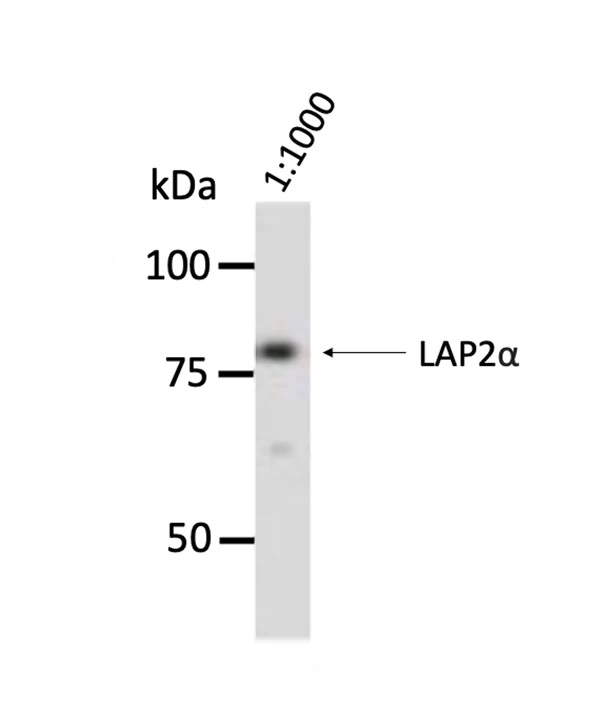 Western blot - Anti-LAP2 alpha Antibody [3A3] (AB316366), expandable thumbnail