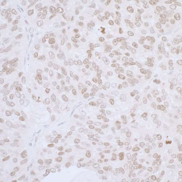 Immunohistochemistry (Formalin/PFA-fixed paraffin-embedded sections) - Anti-LAP2 alpha antibody (AB226336), expandable thumbnail