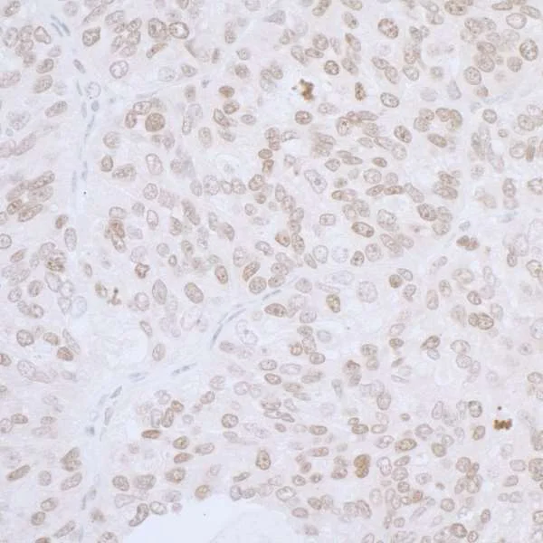 Immunohistochemistry (Formalin/PFA-fixed paraffin-embedded sections) - Anti-LAP2 alpha antibody (AB226336)