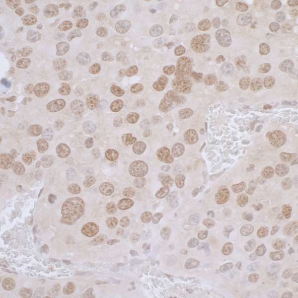 Immunohistochemistry (Formalin/PFA-fixed paraffin-embedded sections) - Anti-LAP2 alpha antibody (AB226336), expandable thumbnail