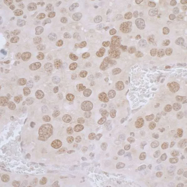 Immunohistochemistry (Formalin/PFA-fixed paraffin-embedded sections) - Anti-LAP2 alpha antibody (AB226336)