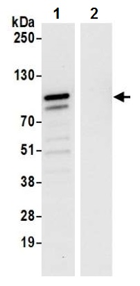Immunoprecipitation - Anti-LAP2 alpha antibody (AB226336), expandable thumbnail