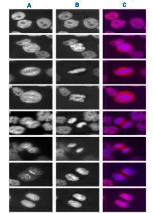Immunocytochemistry/ Immunofluorescence - Anti-LAP2 alpha antibody (AB5162)
