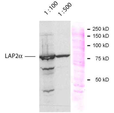 Western blot - Anti-LAP2 alpha antibody (AB5162)