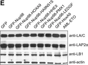 Western blot - Anti-LAP2 alpha antibody (AB5162)