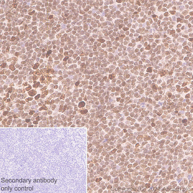 Immunohistochemistry (Formalin/PFA-fixed paraffin-embedded sections) - Anti-LAP2 alpha antibody [EPR28581-87] (AB317028)