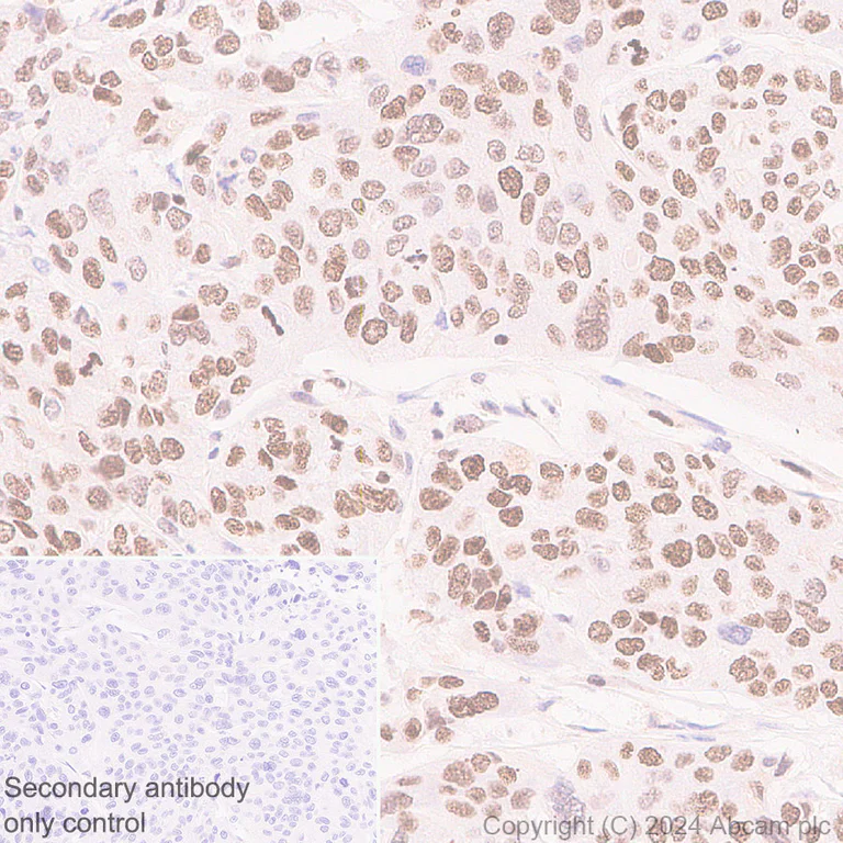 Immunohistochemistry (Formalin/PFA-fixed paraffin-embedded sections) - Anti-LAP2 alpha antibody [EPR28581-87] (AB317028)