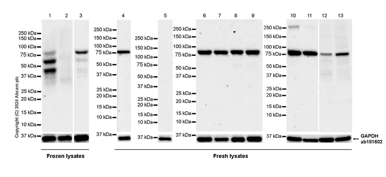 Western blot - Anti-LAP2 alpha antibody [EPR28581-87] (AB317028)
