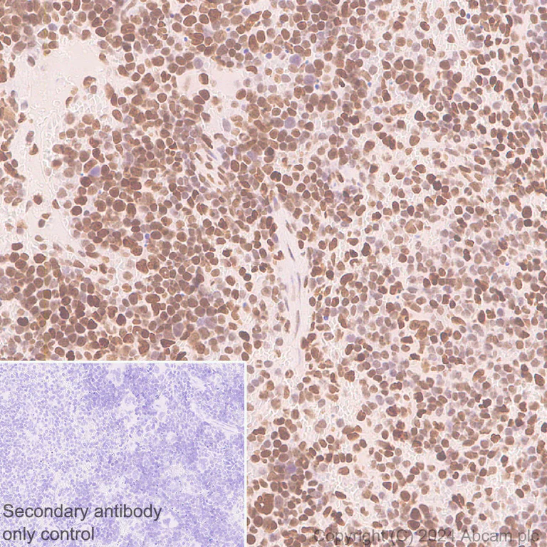Immunohistochemistry (Formalin/PFA-fixed paraffin-embedded sections) - Anti-LAP2 alpha antibody [EPR28581-87] - BSA and Azide free (AB317029)