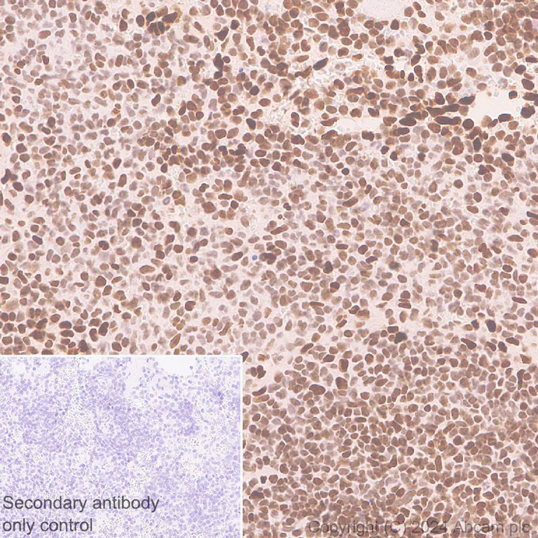 Immunohistochemistry (Formalin/PFA-fixed paraffin-embedded sections) - Anti-LAP2 alpha antibody [EPR28581-87] - BSA and Azide free (AB317029)