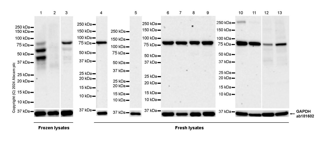 Western blot - Anti-LAP2 alpha antibody [EPR28581-87] - BSA and Azide free (AB317029), expandable thumbnail