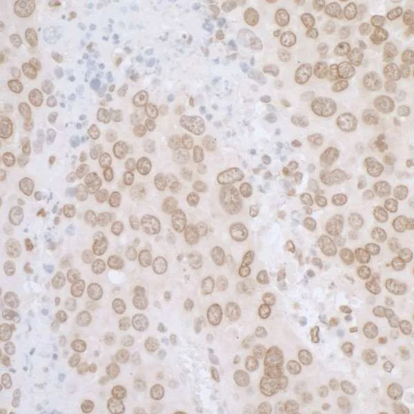 Immunohistochemistry (Formalin/PFA-fixed paraffin-embedded sections) - Anti-LAP2 alpha antibody - N-terminal (AB226342)