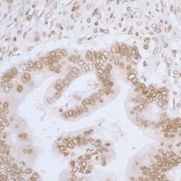 Immunohistochemistry (Formalin/PFA-fixed paraffin-embedded sections) - Anti-LAP2 alpha antibody - N-terminal (AB226342)