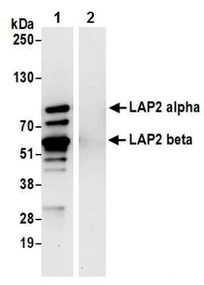Immunoprecipitation - Anti-LAP2 alpha antibody - N-terminal (AB226342)