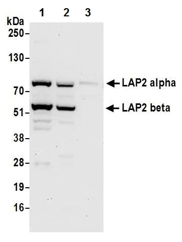 Western blot - Anti-LAP2 alpha antibody - N-terminal (AB226342)