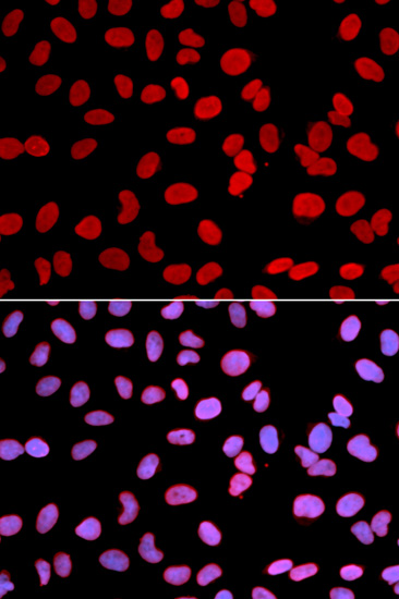 Immunocytochemistry/ Immunofluorescence - Anti-LAP2 antibody (AB185718), expandable thumbnail