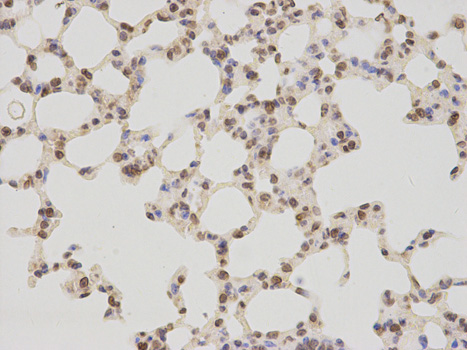 Immunohistochemistry (Formalin/PFA-fixed paraffin-embedded sections) - Anti-LAP2 antibody (AB185718), expandable thumbnail