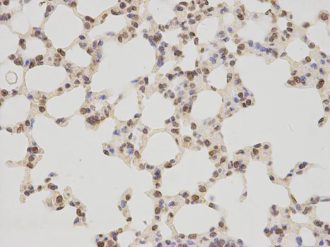 Immunohistochemistry (Formalin/PFA-fixed paraffin-embedded sections) - Anti-LAP2 antibody (AB185718)