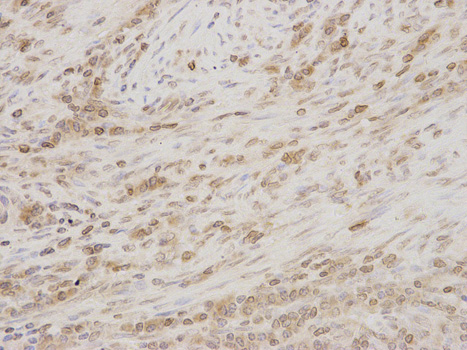 Immunohistochemistry (Formalin/PFA-fixed paraffin-embedded sections) - Anti-LAP2 antibody (AB185718), expandable thumbnail
