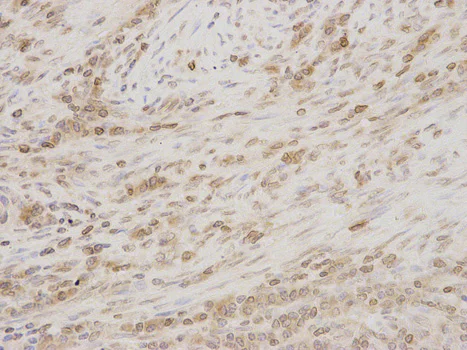 Immunohistochemistry (Formalin/PFA-fixed paraffin-embedded sections) - Anti-LAP2 antibody (AB185718)