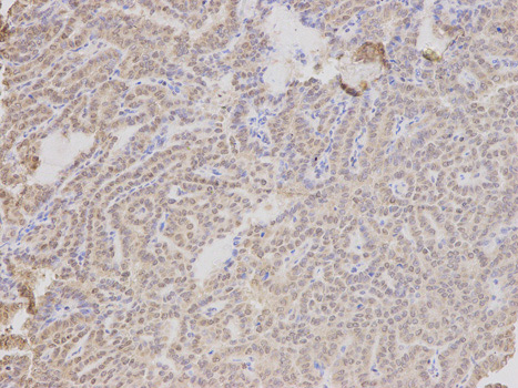Immunohistochemistry (Formalin/PFA-fixed paraffin-embedded sections) - Anti-LAP2 antibody (AB185718), expandable thumbnail