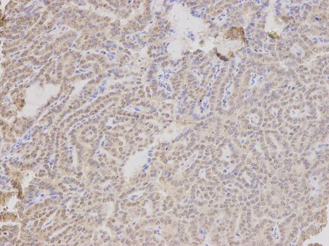 Immunohistochemistry (Formalin/PFA-fixed paraffin-embedded sections) - Anti-LAP2 antibody (AB185718)