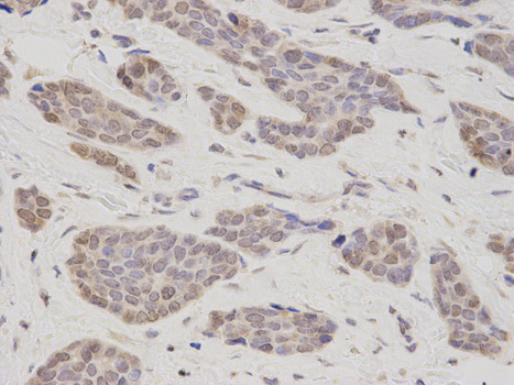 Immunohistochemistry (Formalin/PFA-fixed paraffin-embedded sections) - Anti-LAP2 antibody (AB185718), expandable thumbnail