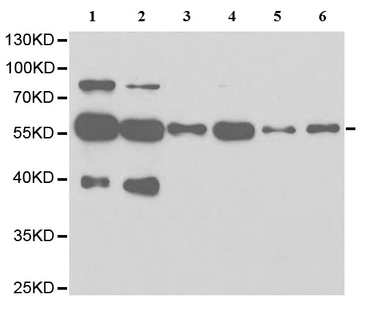 Western blot - Anti-LAP2 antibody (ab185718), expandable thumbnail