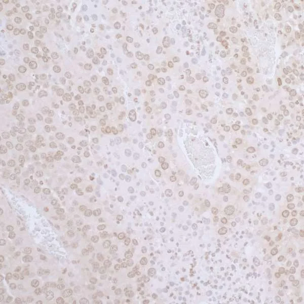 Immunohistochemistry (Formalin/PFA-fixed paraffin-embedded sections) - Anti-LAP2 antibody (AB226348)