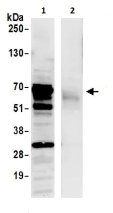 Immunoprecipitation - Anti-LAP2 antibody (AB226348)